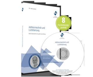 Adhäsivtechnik und Lichthärtung