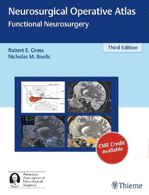Neurosurgical Operative Atlas: Functional Neurosurgery - 