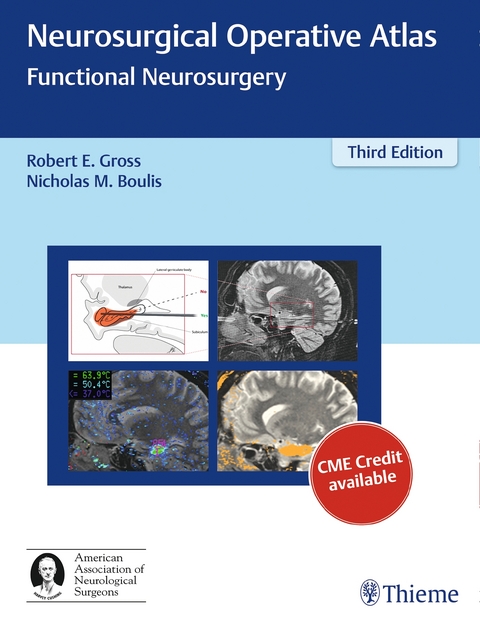 Neurosurgical Operative Atlas: Functional Neurosurgery - 