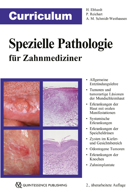 Curriculum Spezielle Pathologie f&uuml;r Zahnmediziner - Harald Ebhardt, Peter A. Reichart, Andrea Maria Schmidt-Westhausen