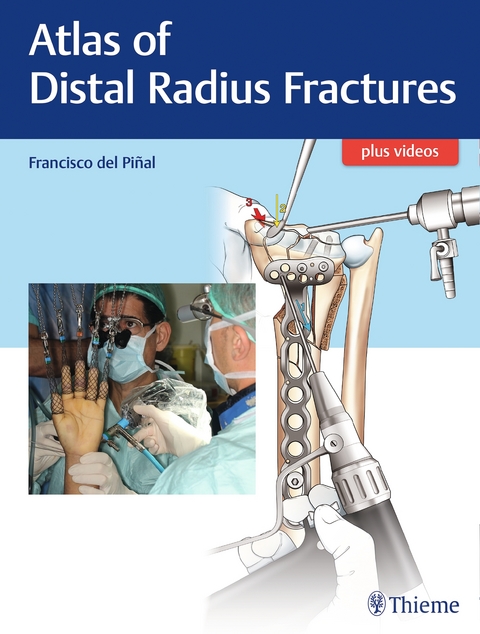 Atlas of Distal Radius Fractures - Francisco del Pinal