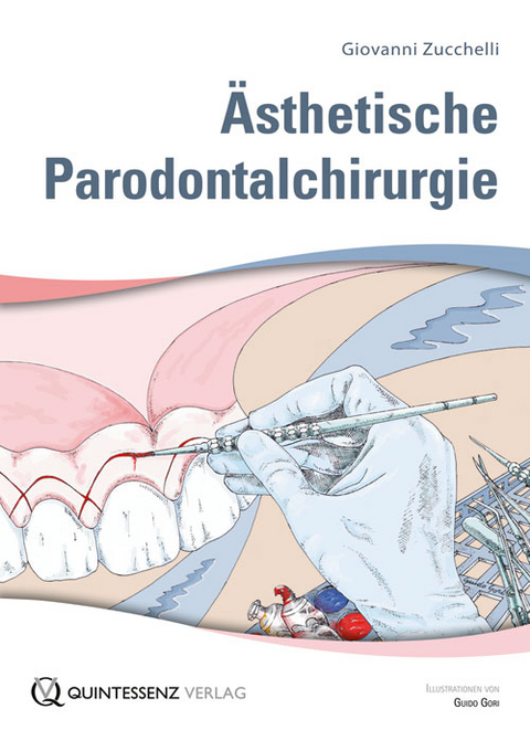 &Auml;sthetische Parodontalchirurgie - Giovanni Zucchelli