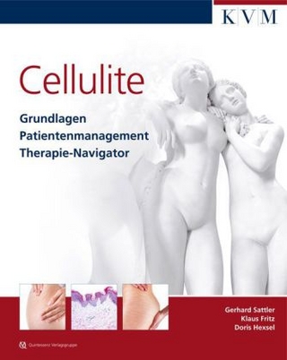 Cellulite