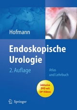 Endoskopische Urologie - 