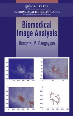 Biomedical Image Analysis -  Rangaraj M. Rangayyan