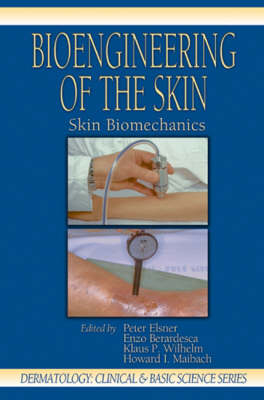 Bioengineering of the Skin - 