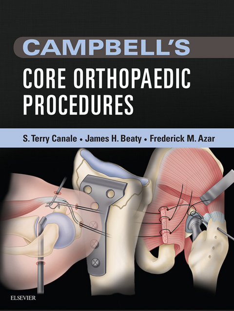 Campbell's Core Orthopaedic Procedures E-Book -  Frederick M. Azar,  James H. Beaty,  S. Terry Canale