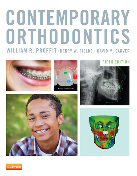Contemporary Orthodontics - E-Book -  Henry Fields,  William R. Proffit
