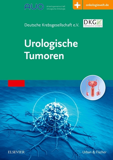 Urologische Tumoren - 