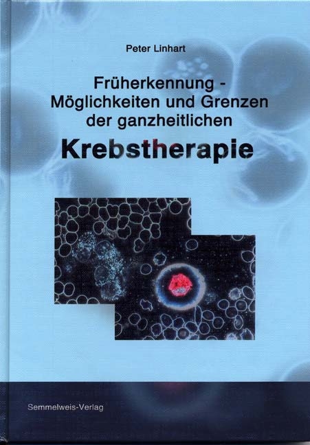 Fr&uuml;herkennung - M&ouml;glichkeiten und Grenzen der ganzheitlichen Krebstherapie - Peter Linhart