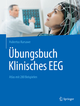 Übungsbuch Klinisches EEG - Hubertus Kursawe