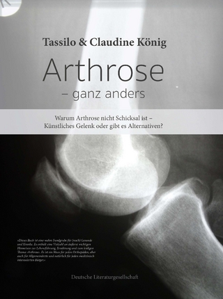 Arthrose – ganz anders