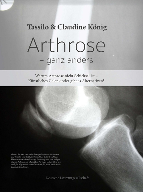 Arthrose &ndash; ganz anders - Tassilo K&ouml;nig, Claudine K&ouml;nig