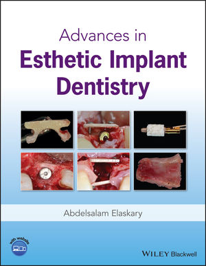 Advances in Esthetic Implant Dentistry