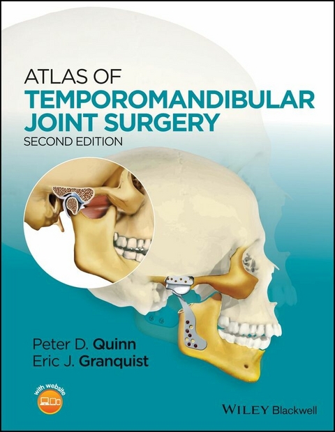 Atlas of Temporomandibular Joint Surgery - 