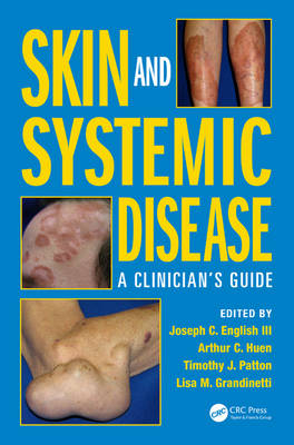 Skin and Systemic Disease - University of Pittsburgh Medical Center Joseph C. (Professor of Dermatology  PA  USA) English III,  Timothy J. Patton