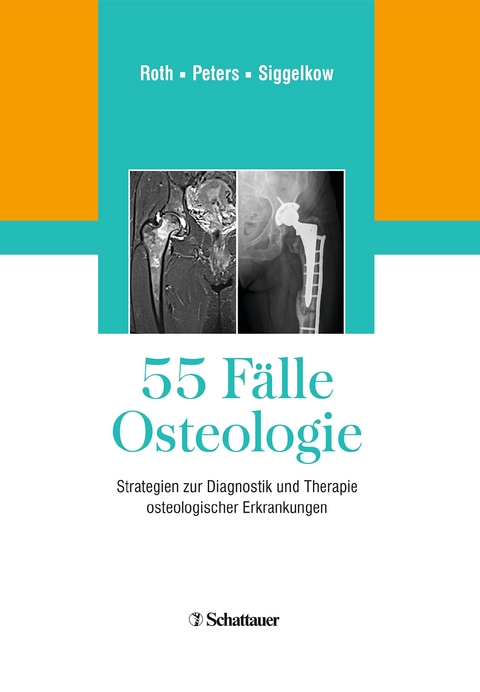 55 F&auml;lle Osteologie - 