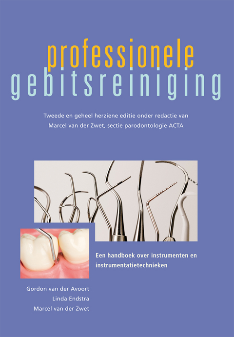 Professionele gebitsreiniging - 