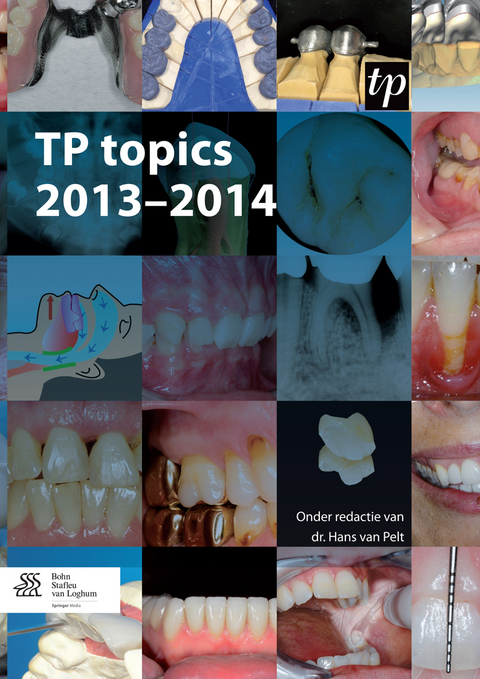 TP topics 2013-2014 - 