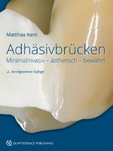 Adhäsivbrücken - Kern, Matthias