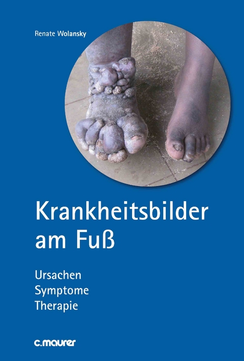 Krankheitsbilder am Fu&szlig; - Renate Wolansky