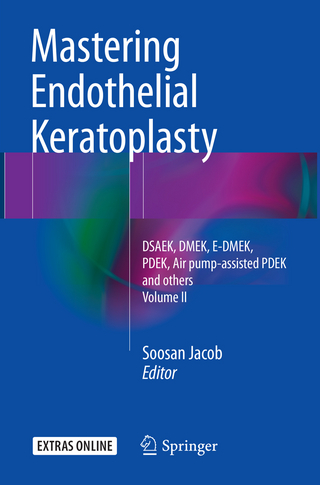 Mastering Endothelial Keratoplasty