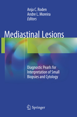 Mediastinal Lesions