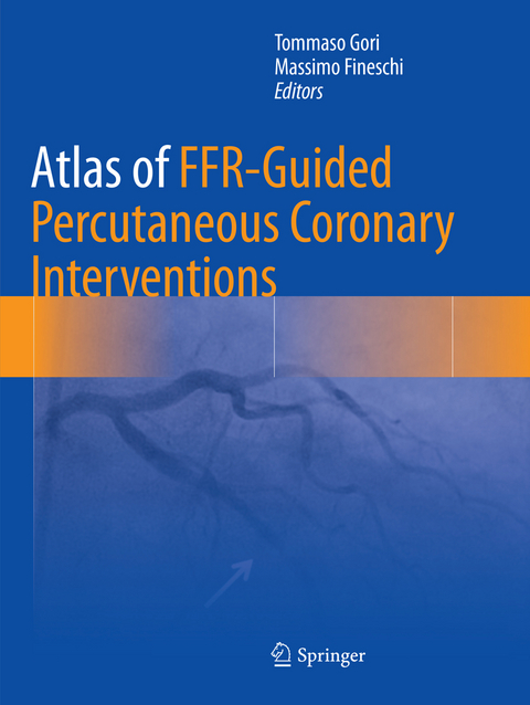 Atlas of FFR-Guided Percutaneous Coronary Interventions - 