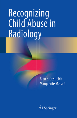 Recognizing Child Abuse in Radiology