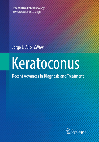 Keratoconus