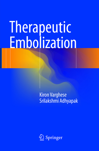Therapeutic Embolization