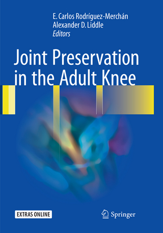 Joint Preservation in the Adult Knee