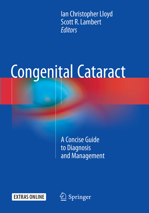 Congenital Cataract - 