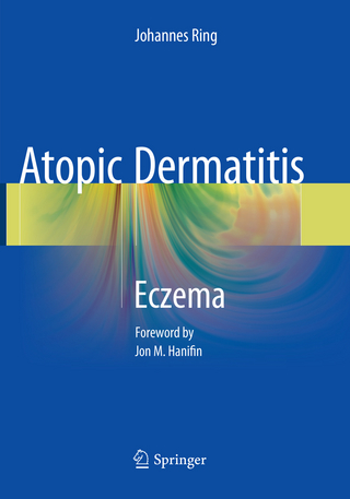 Atopic Dermatitis