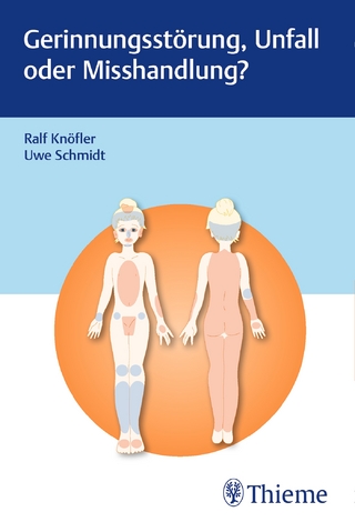 Gerinnungsstörung, Unfall oder Misshandlung?