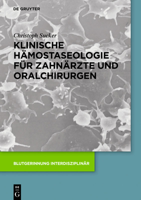 Klinische H&auml;mostaseologie f&uuml;r Zahn&auml;rzte und Oralchirurgen - Christoph Sucker