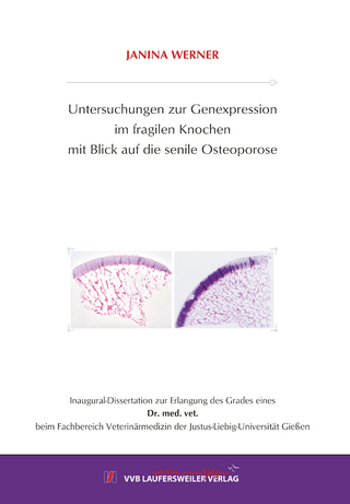 Untersuchungen zur Genexpression im fragilen Knochen mit Blick auf die senile Osteoporose
