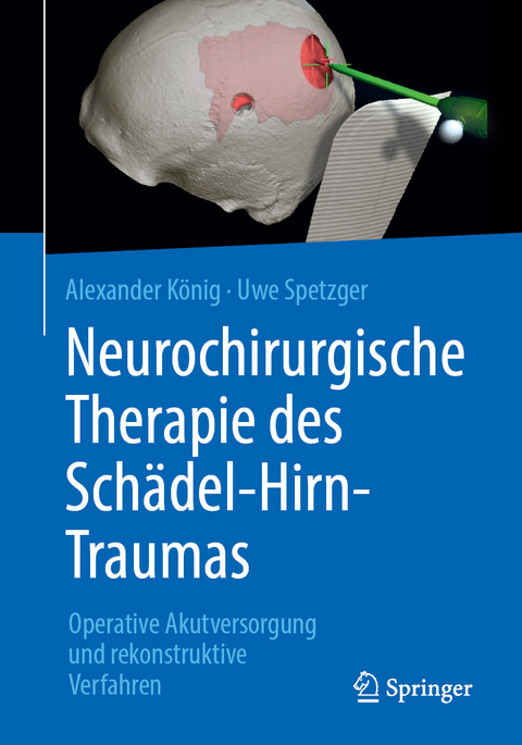 Neurochirurgische Therapie des Sch&auml;del-Hirn-Traumas - Alexander K&ouml;nig, Uwe Spetzger