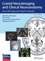 Cranial Neuroimaging and Clinical Neuroanatomy - Lanfermann, Heinrich; Raab, Peter; Kretschmann, Hans-Joachim; Weinrich, Wolfgang