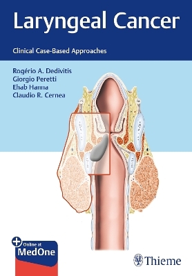 Laryngeal Cancer - Rogerio Dedivitis, Giorgio Peretti, Ehab Hanna, Claudio Roberto Cernea