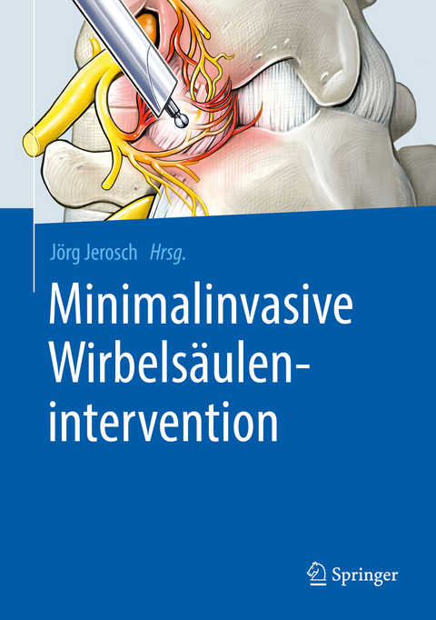 Minimalinvasive Wirbelsäulenintervention - 