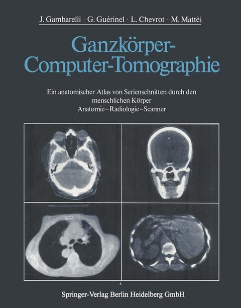 Ganzk&ouml;rper-Computer-Tomographie - J. Gambarelli, G. Guerinel, L. Chevrot, M. Mattei