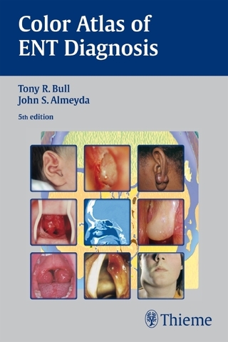 Bull's Color Atlas of ENT Diagnosis
