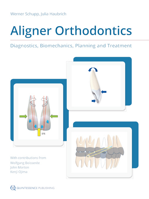 Aligner Orthodontics - Werner Schupp, Julia Haubrich