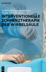 Interventionelle Schmerztherapie der Wirbels&auml;ule - 