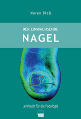 Der einwachsende Nagel - Maren Blo&szlig;