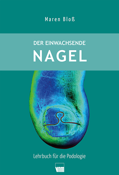 Der einwachsende Nagel - Maren Blo&szlig;