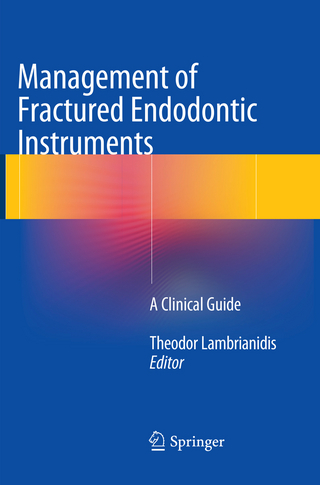 Management of Fractured Endodontic Instruments