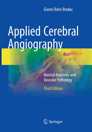 Applied Cerebral Angiography