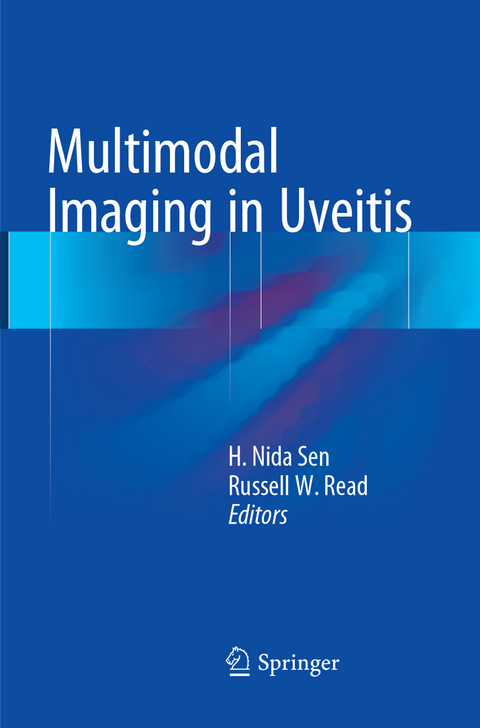 Multimodal Imaging in Uveitis - 